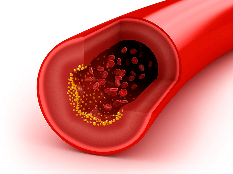 Você sabe o que é o colesterol HDL e o LDL?