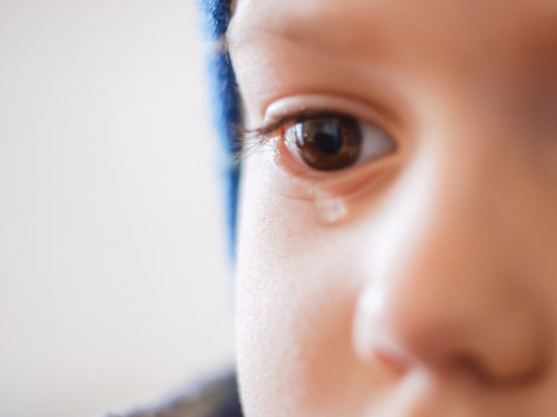 Tracoma: O que é, sintomas, tratamentos e causas